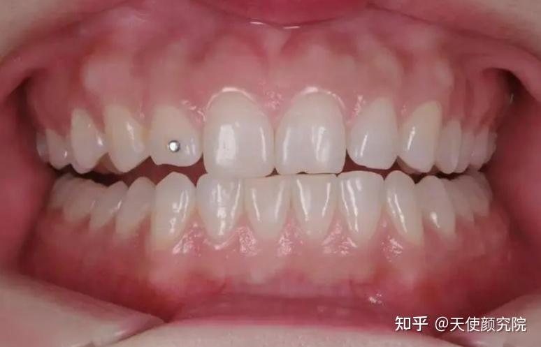 郑秀妍这段太蛊了吧!芒果台怎么能删了不播??!(郑秀妍签约英皇)