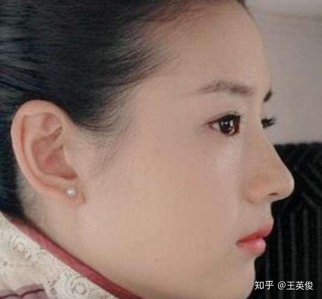 怎么让鼻子更挺更好看 v2-3770e28638f76e96b14f96712733cad9_r.jpg