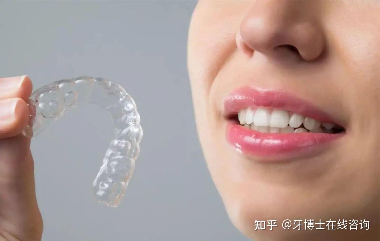 牙齿矫正的方式有哪些盘点不同牙套整牙价位