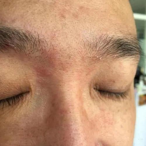 怎么养成一张干净的脸?