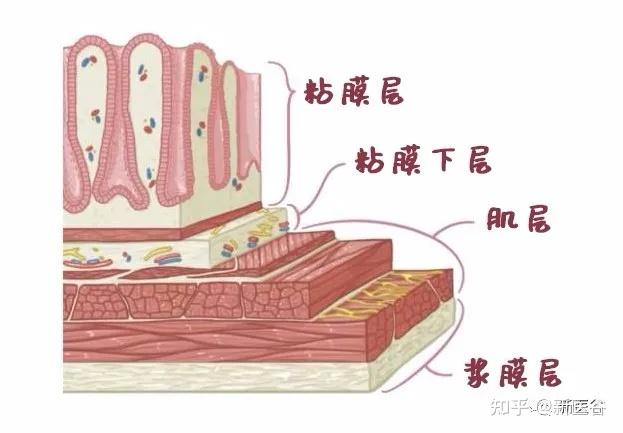 胃壁可不是普普通通的"细胞块"砌成,而是由粘膜,粘膜下层,肌层和浆膜