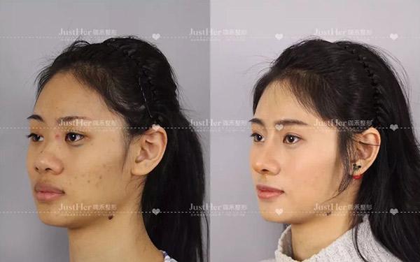 v2-37818033881ba9f86d55ab5d3487852f_1440w.jpg?source=172ae18b