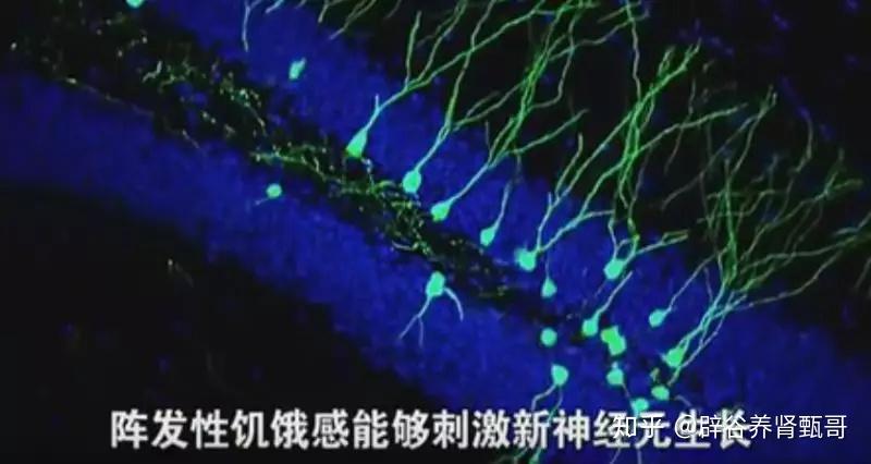 v2-37f6806f1edf1f6e591d6d21cdb6e8d6_r.jpg