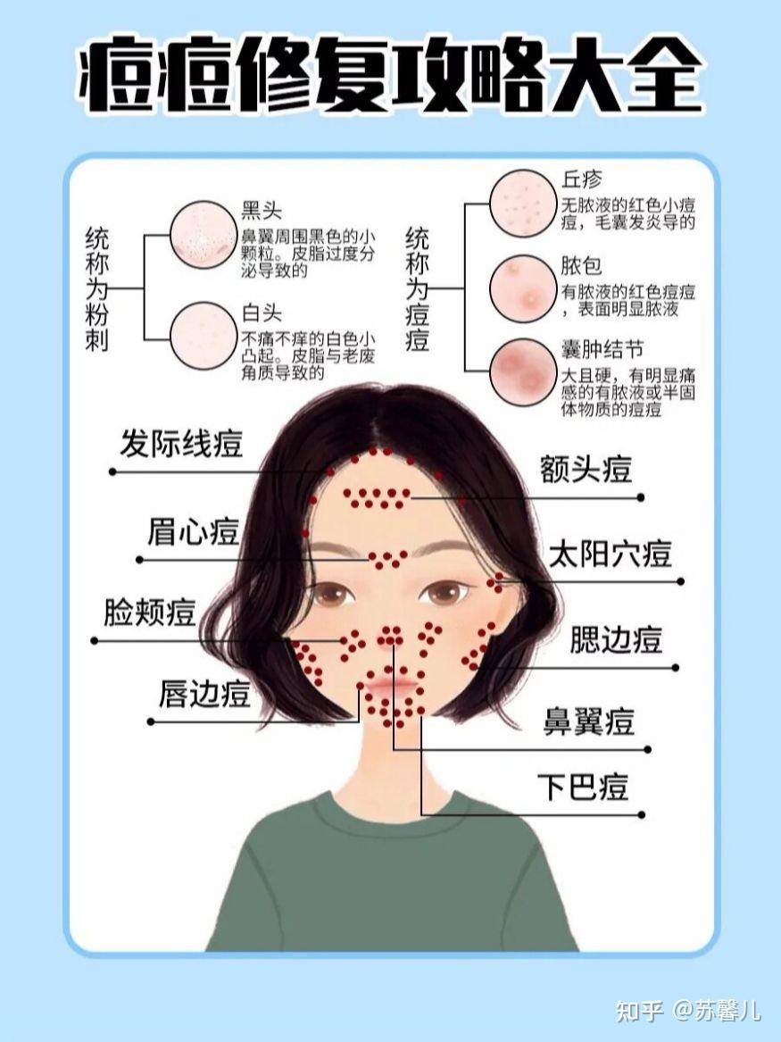 痘痘分布图解女性图片