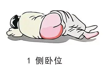 菊部问题总不好直肠指检你值得拥有