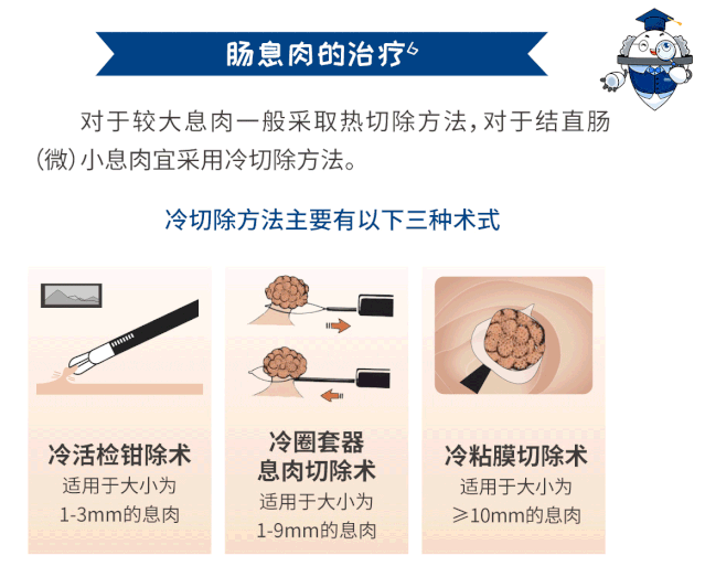 结直肠癌95是由肠息肉演变而来如何防治肠息肉