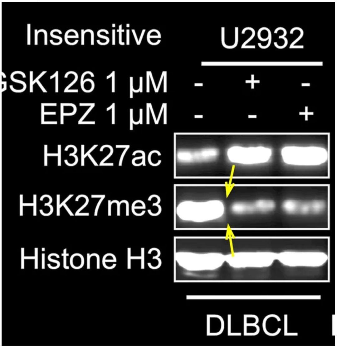 journal of cancer论文论文题目:phosphoglycerate mutas