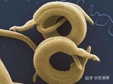 什么叫免疫性血小板减少症 v2-38751886d6f1456afded31a8d17bdfe6_b.jpg