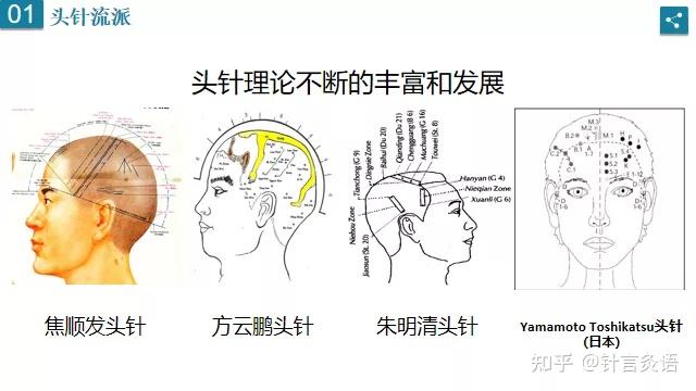 以及国家相关组织制定头针技术操作规范,who通过了《头皮针穴名标准化