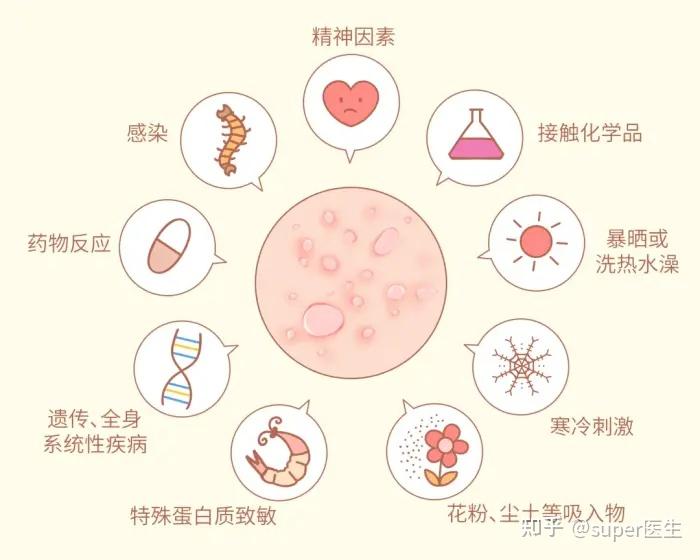 溼疹和特應性皮炎有什麼聯繫應該看皮膚科還是兒科