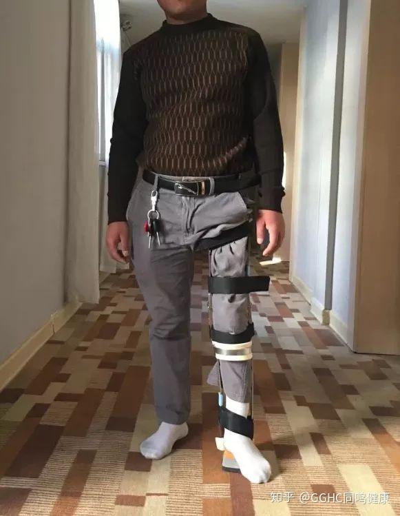 他是一位在吉林生活,经营着慕残者直播网红号(devotee live)的残障男