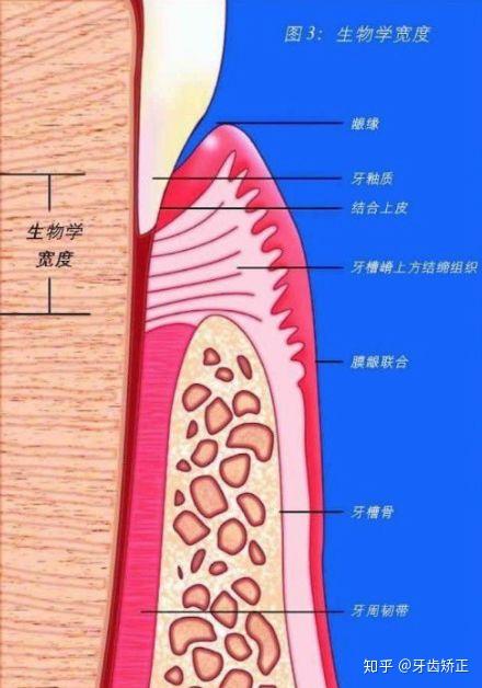 生物学宽度biologic width:指的是牙龈龈沟底至牙槽骨顶部的距离
