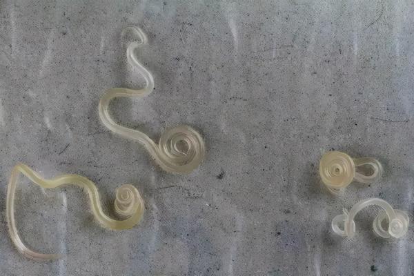 因为贪吃 男子脑子长虫了 这些 美食 里满是虫子 你还经常吃 知乎