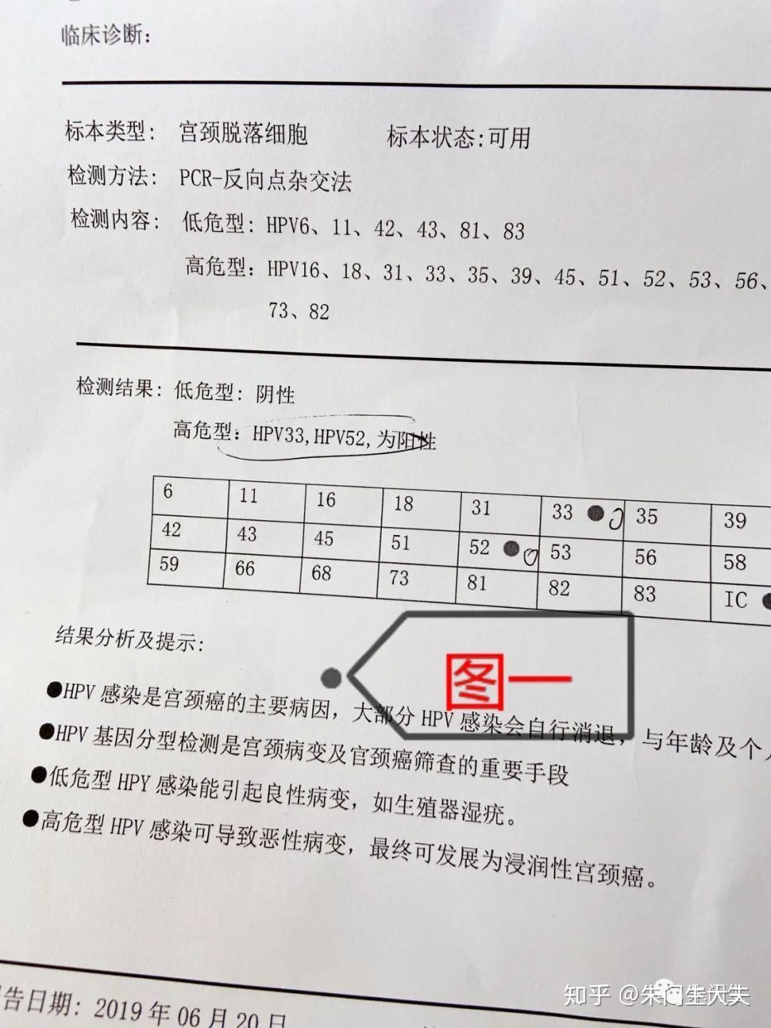 沈阳孙女士hpv33hpv52型低高危转阴病例分享