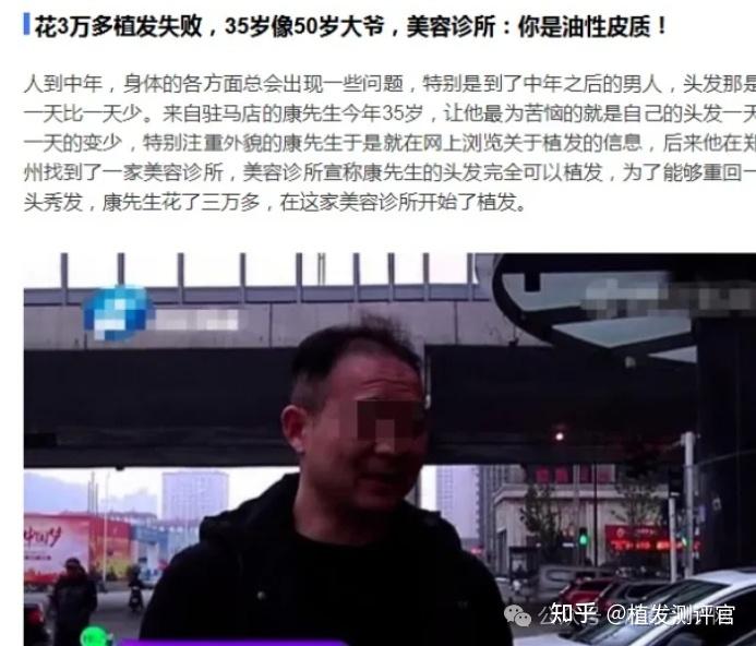 大连有哪些正规的植发医院?大连植发要多少钱? - 知乎