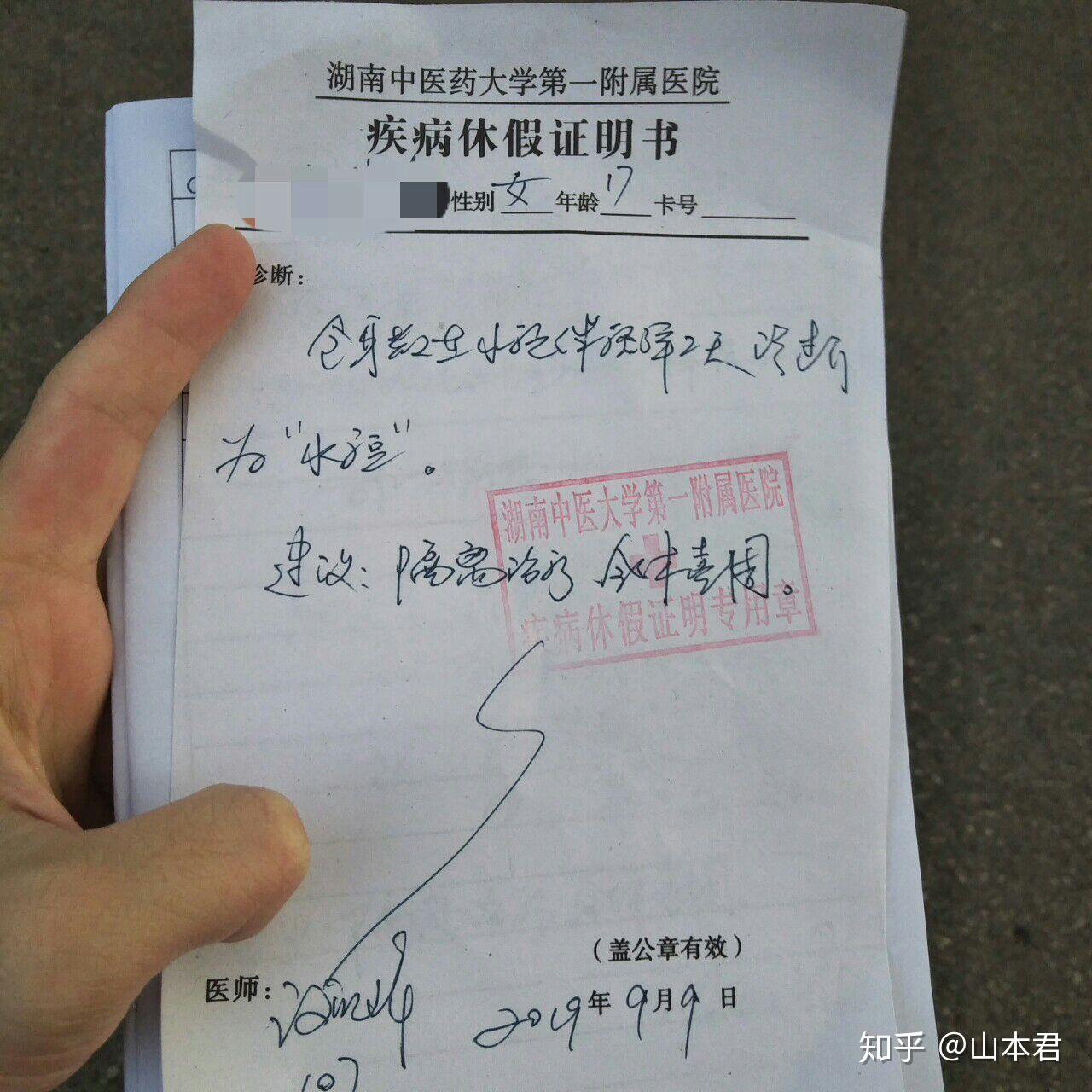 水痘的治疗过程