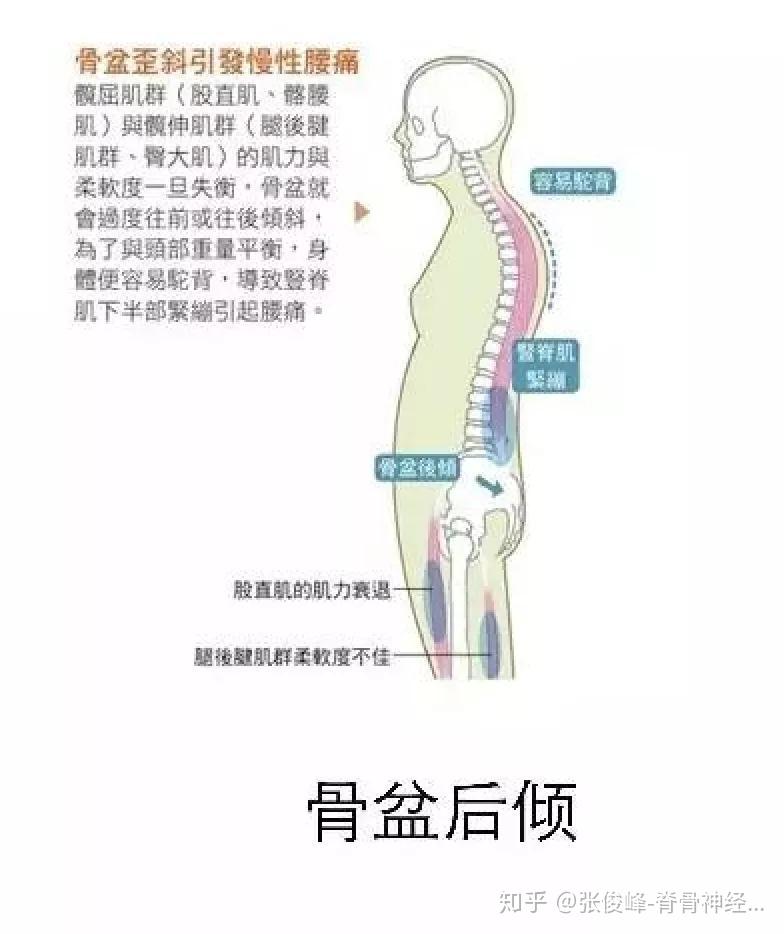 骨盆人體地基不可傾斜