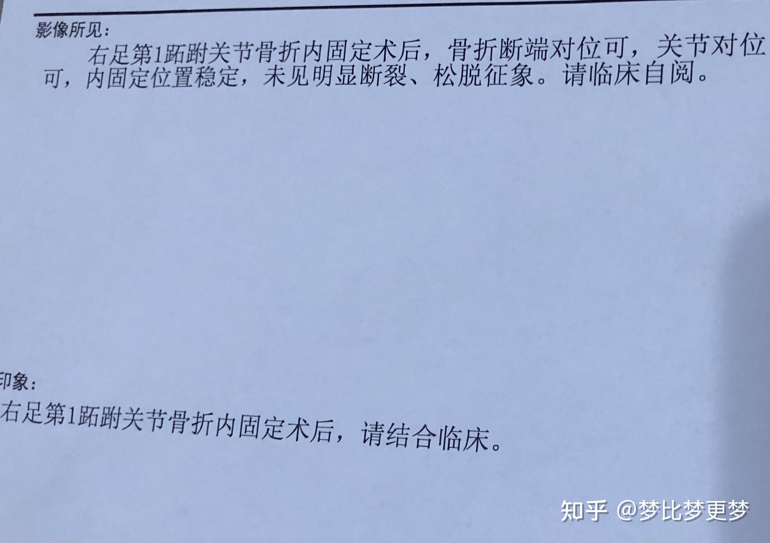 右脚第一跖骨基底部骨折日志右脚lisfranc损伤