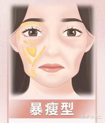 面颊凹陷、颧骨凸出、瘦脱相人群必看的自救指南！附对症处理方案 - 知乎