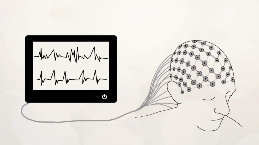 由于eeg记录的是大脑的总体电活动,因此eeg对于探讨认知过程存在一定