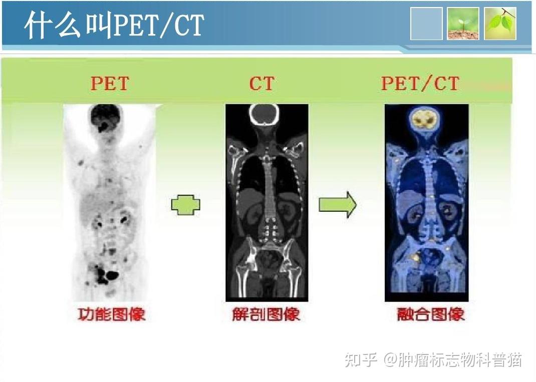 什么时候需要做pet-ct?价格这么贵医保是否报销?