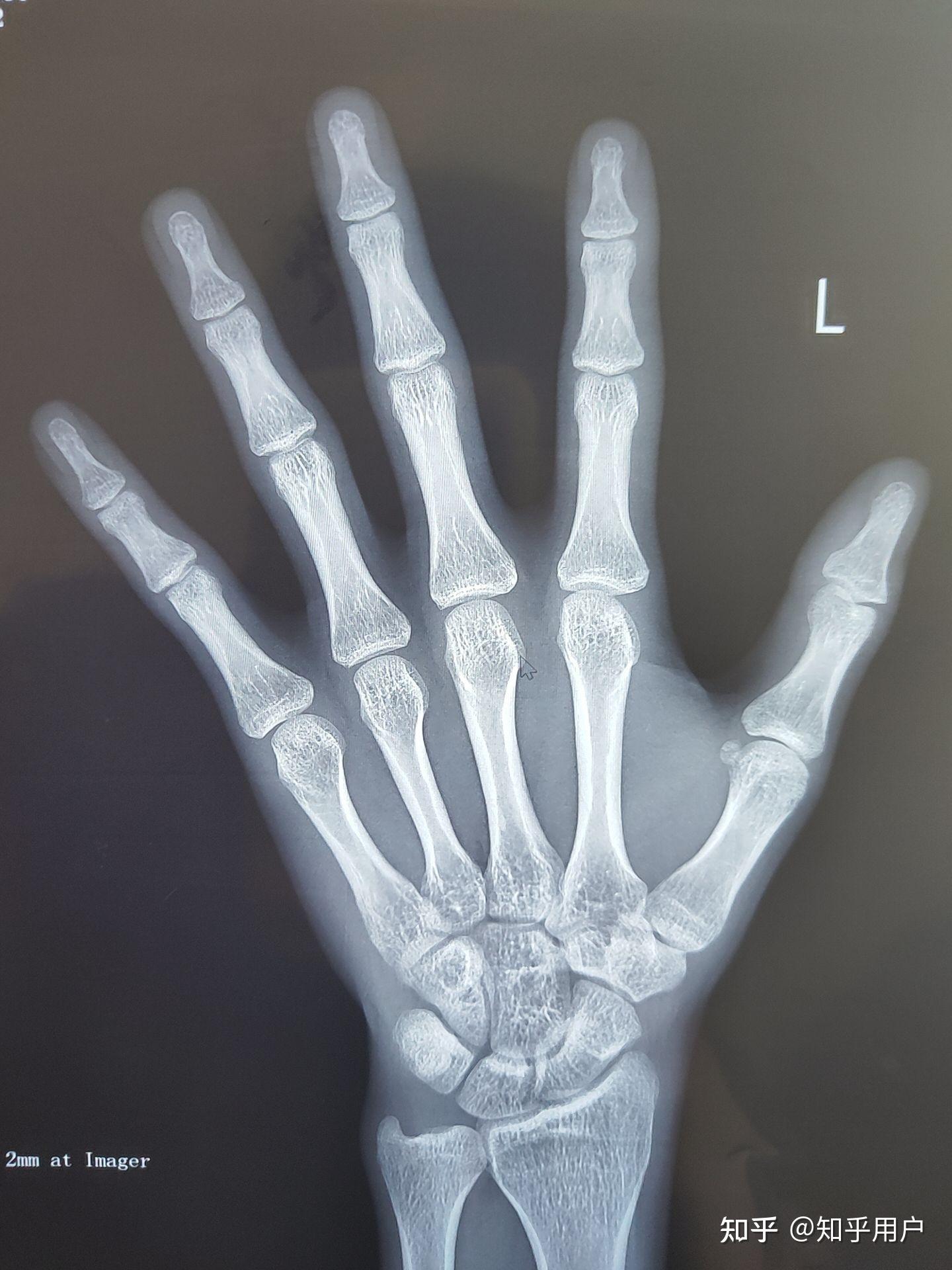 有没有大神留言帮我看看骨缝线