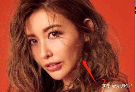 削完下颌角脸还是大_方脸削下颌角_削下颌角的后遗症