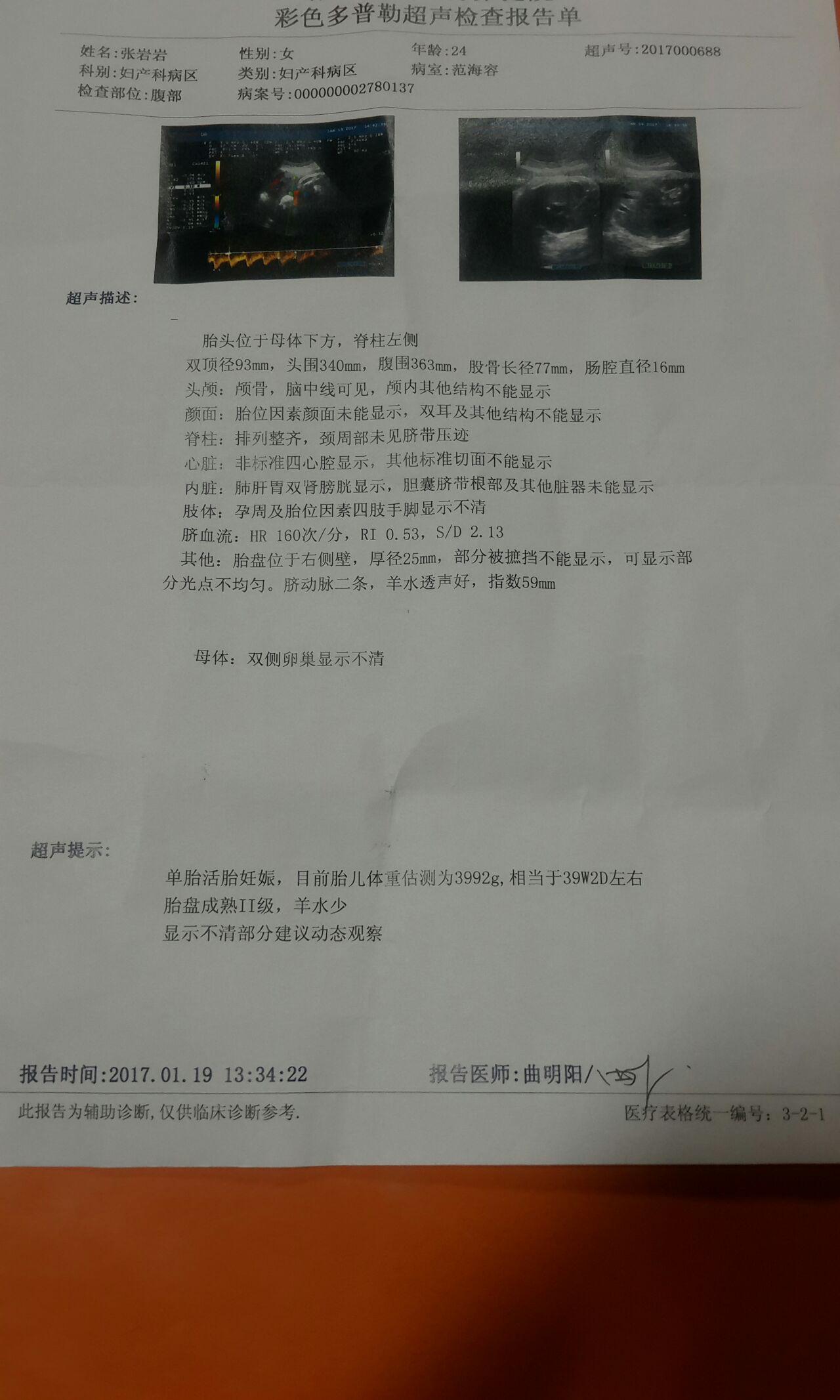 孕后期,胎盘成熟度2级,胎儿体重估测3992g ,相