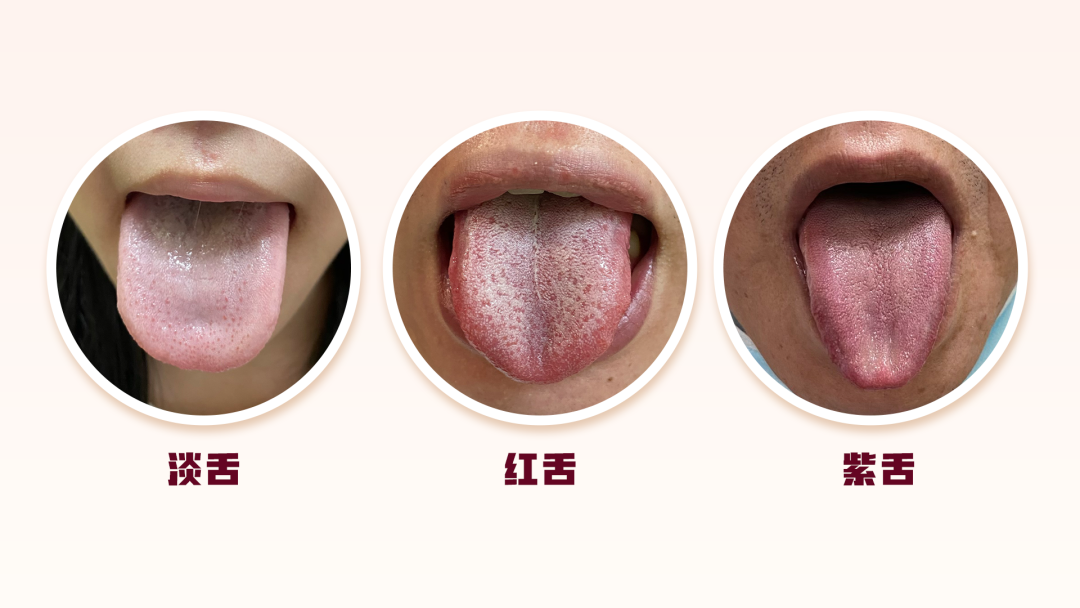 3分钟学会看舌象,提前预知身体健康状况 - 知乎