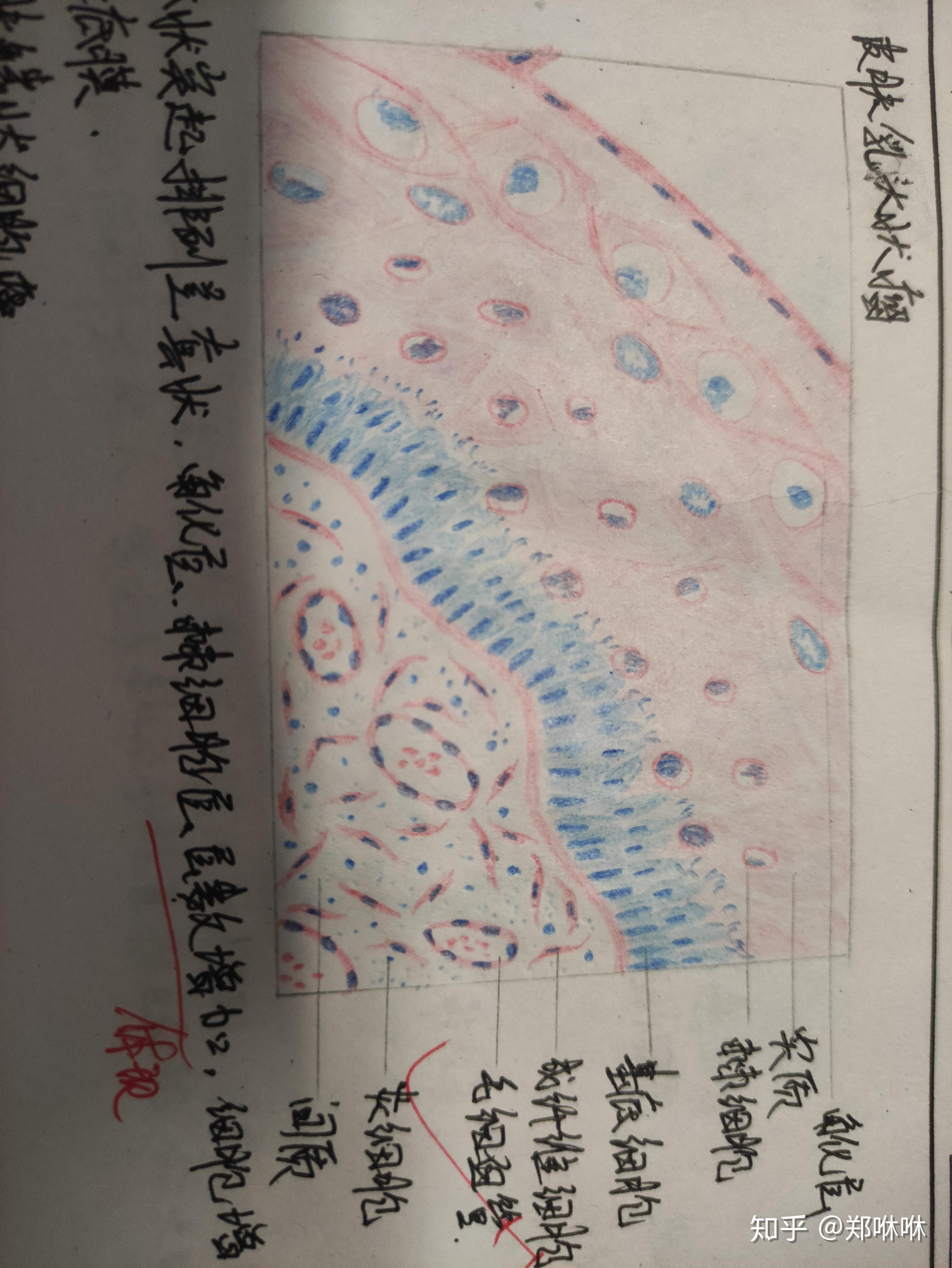 肝脓肿红蓝铅笔手绘图图片