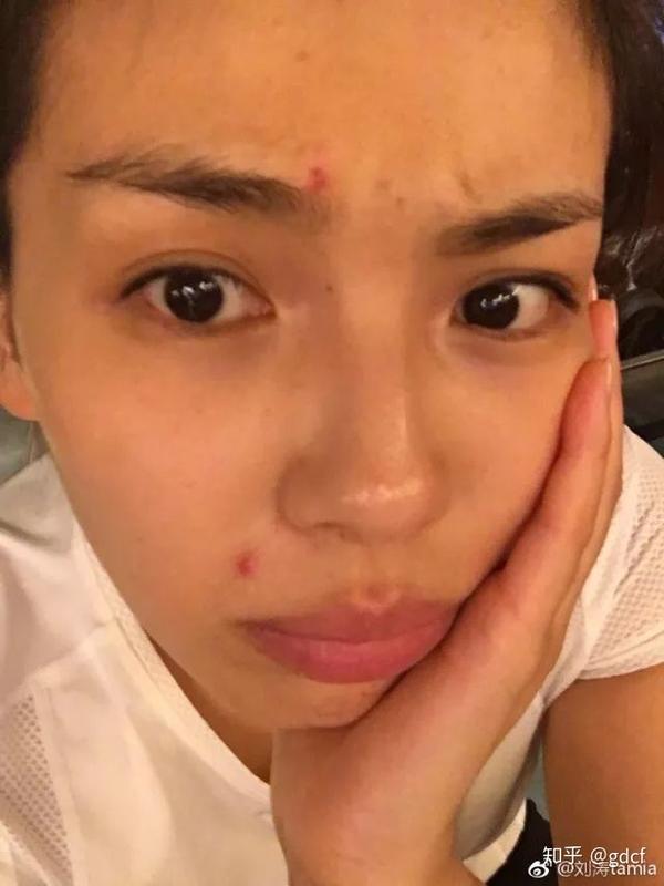 女明星熬夜拍戏照样长痘,她们还不是靠这几招续命!