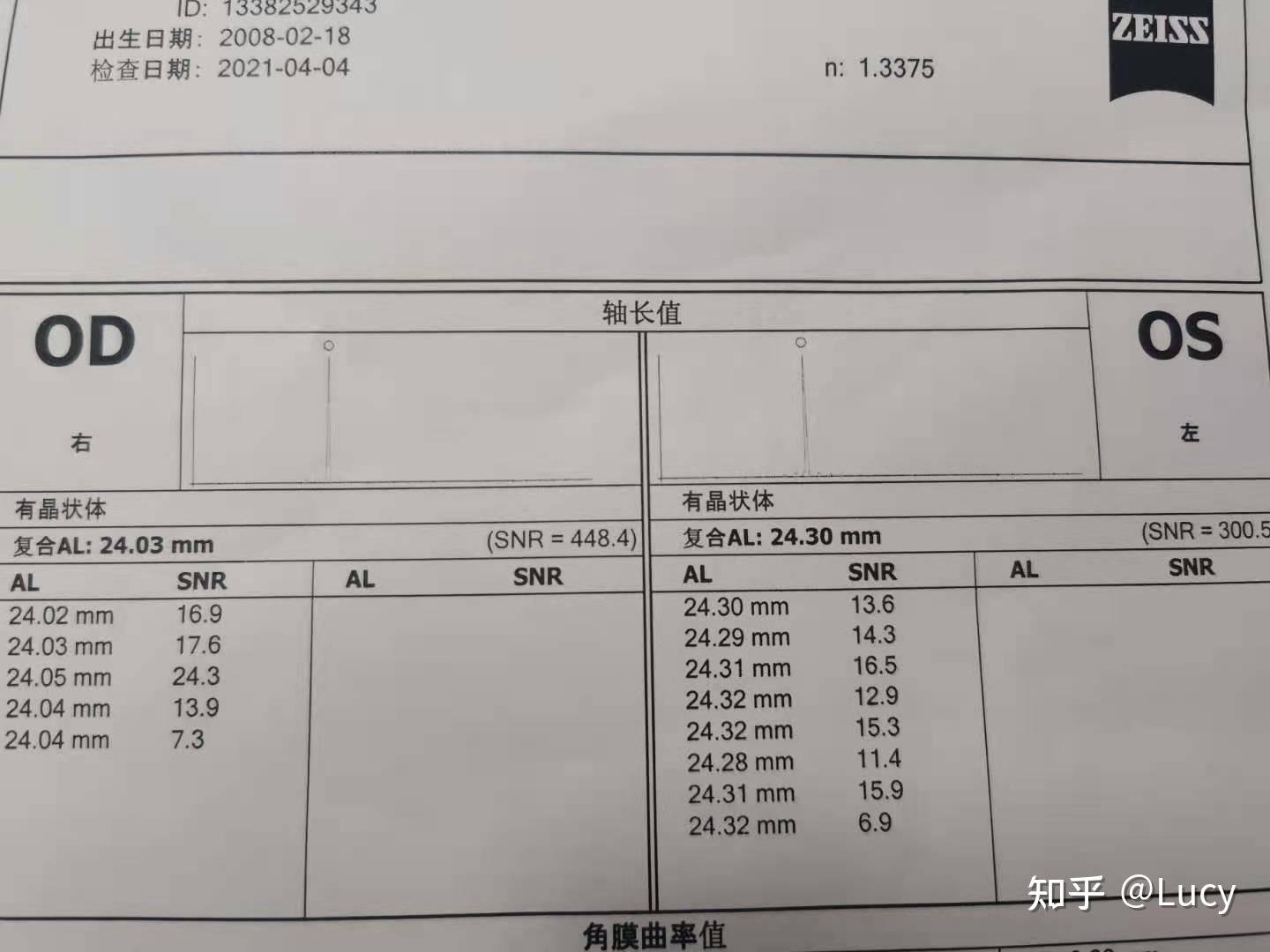 23,角膜曲率41,需要上ok鏡嗎辰辰的防控日記作者lamp不必過於焦慮