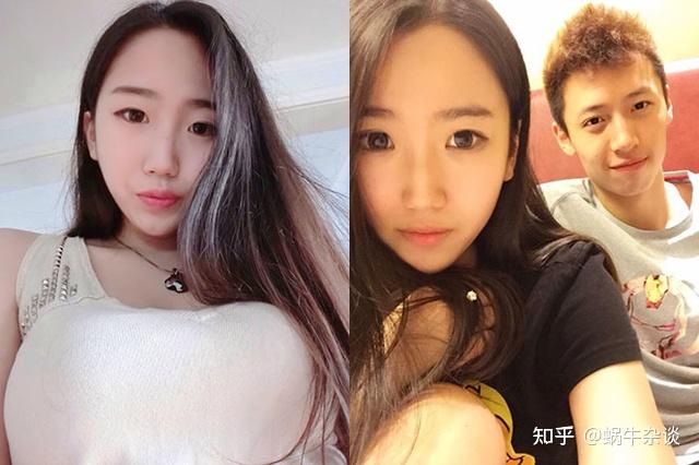 饱受伤病困扰的中国库里,获得5年顶薪合同,和漂亮女友青梅竹马