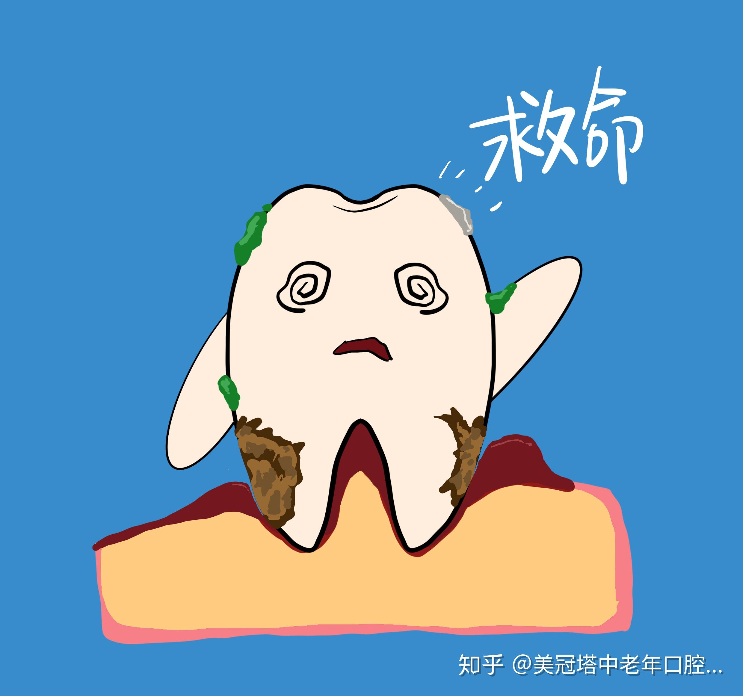 中老年松牙保卫战牙疼是病必须治老掉牙不是自然规律