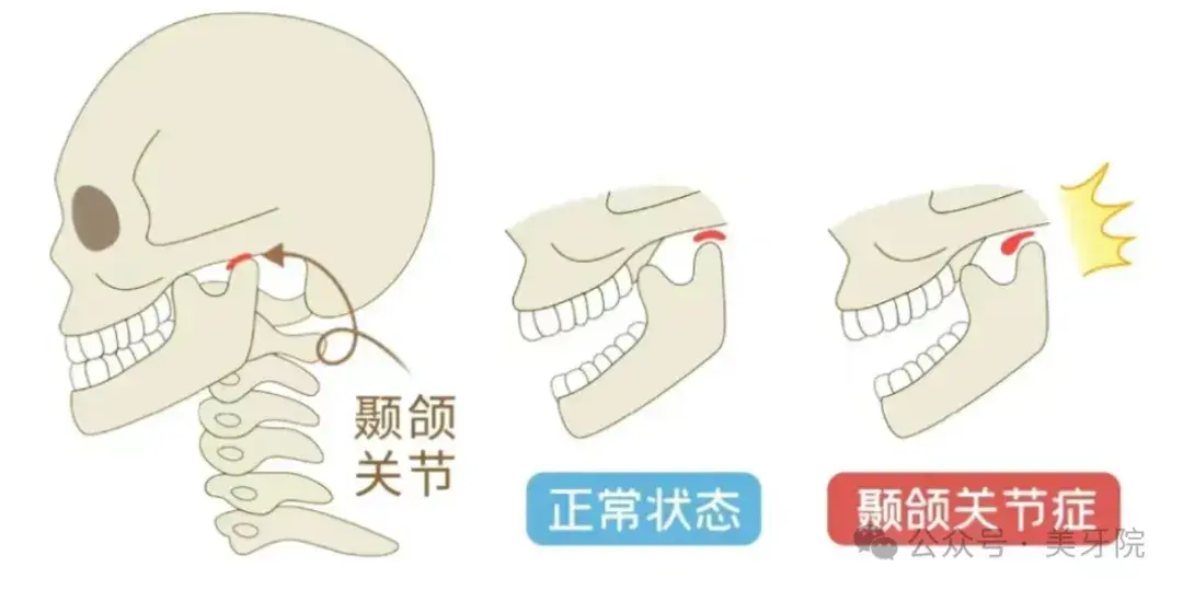 牙齿也有‘中年危机’?40岁后必须警惕的4个变化 - 知乎