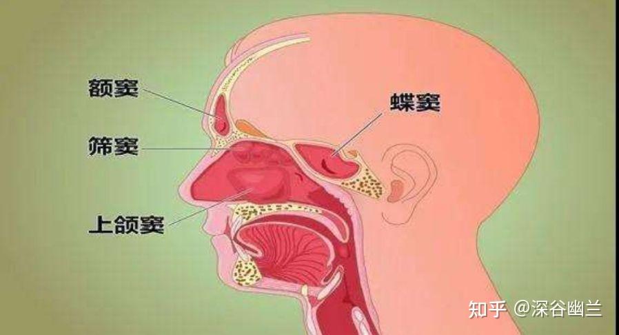 蝶窦囊肿图片图片