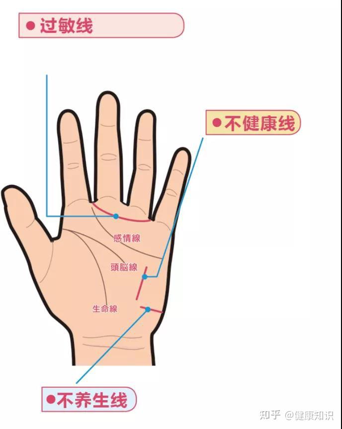 不适的时候手掌上会出现的线条在东方医学上,只要看手掌上的主要三线