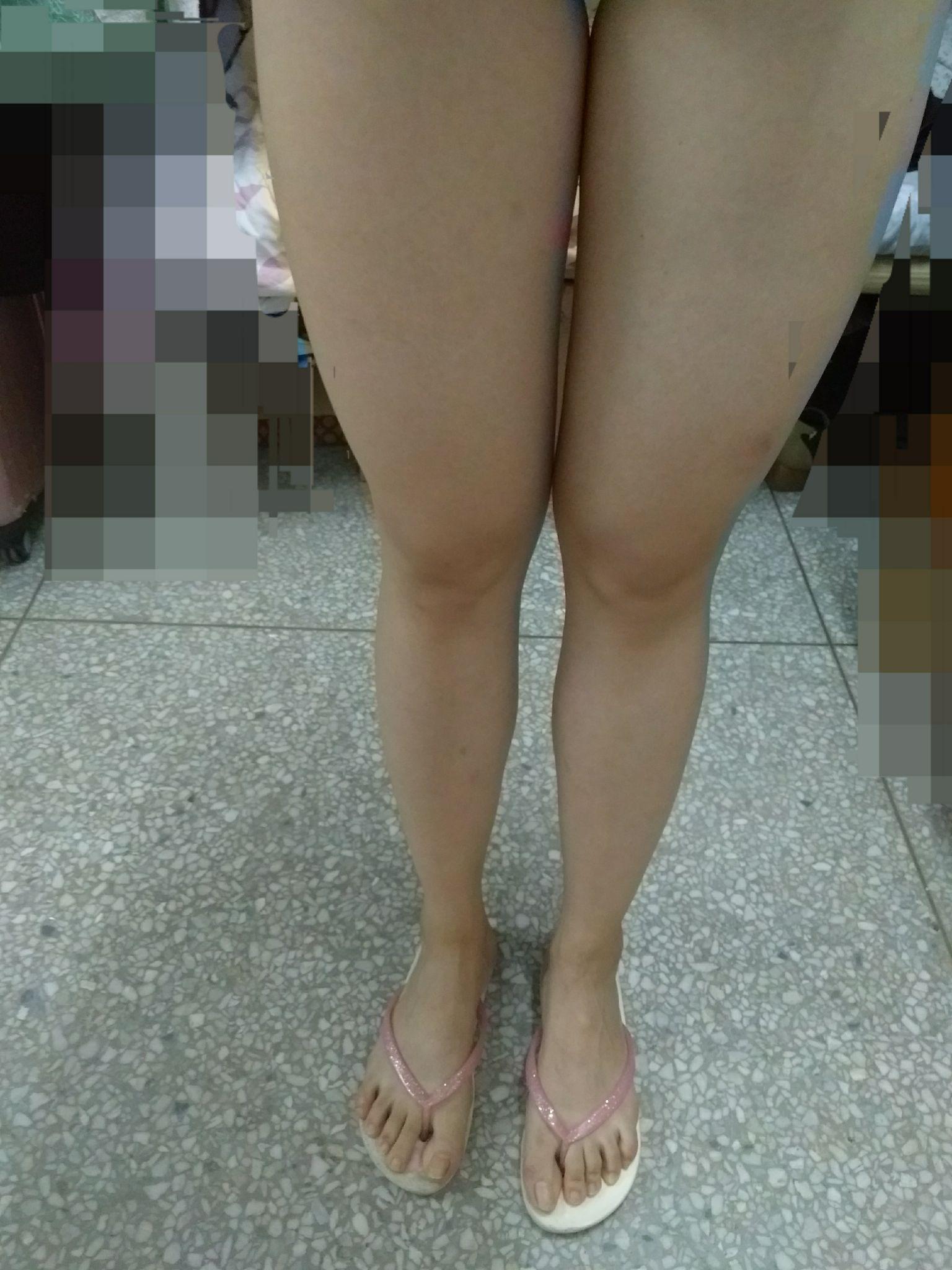 如何减大腿内侧的肉 v2-3d51e6f438b355684d3ef9c34299e41a_r.jpg