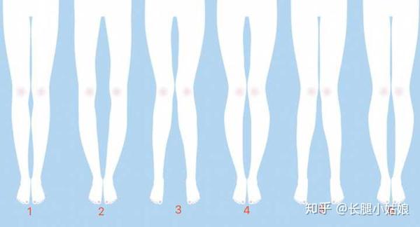 什么是xo型腿 Xo型腿如何锻炼 按摩矫正 如何细 直小腿 看这一篇就够了 知乎