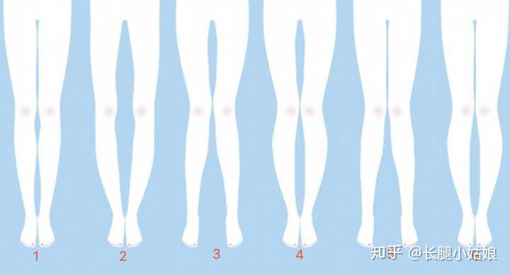 首先我们来认识一下常见的腿型1和5都是正常腿型,5稍微有点膝盖内收