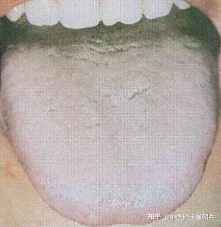 最全舌诊图解!中医教你4大方法,看舌头懂健康,收藏备用 - 知乎