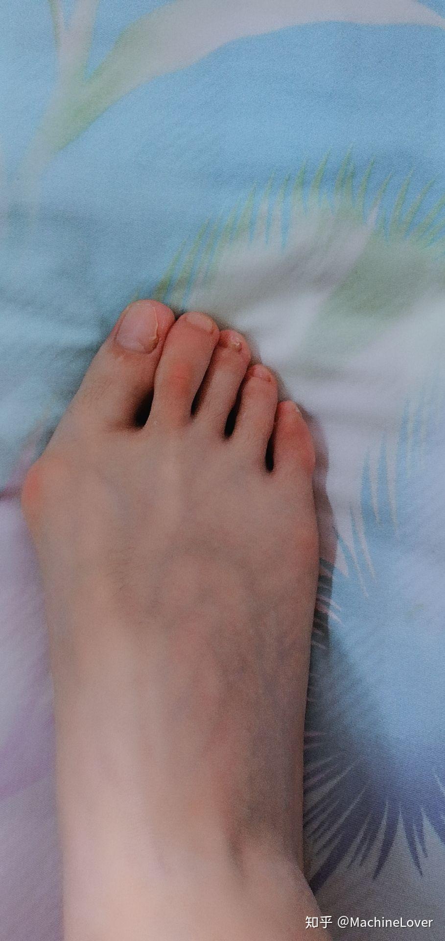 女生脚丑是种什么样的体验