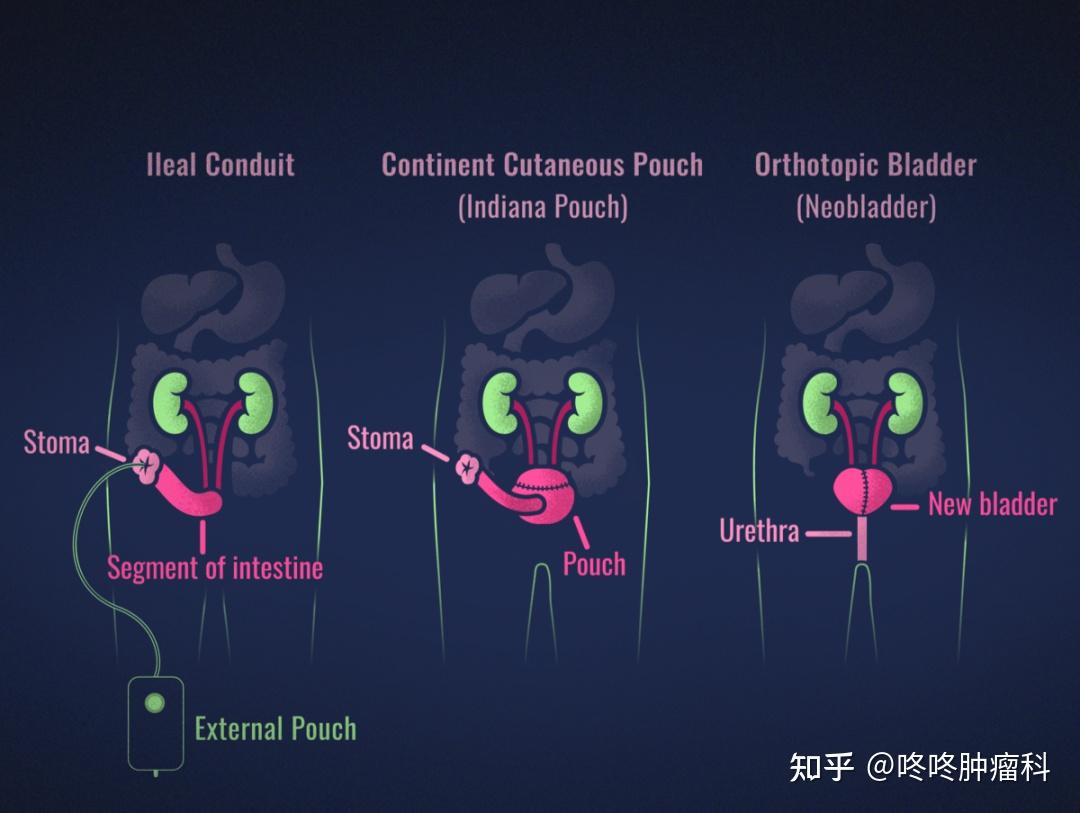 蓄尿と排尿の仕組みを解説！排尿筋や括約筋の働きをわかりやすく！