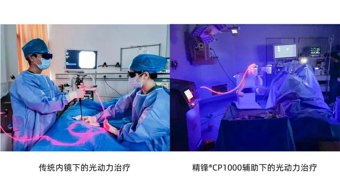 重磅!精锋®支气管镜机器人CP1000获NMPA上市批准! - 知乎