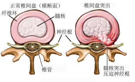 v2-3eae2f17dcd675dca45cee2dc411b58c_1440w.jpg?source=172ae18b