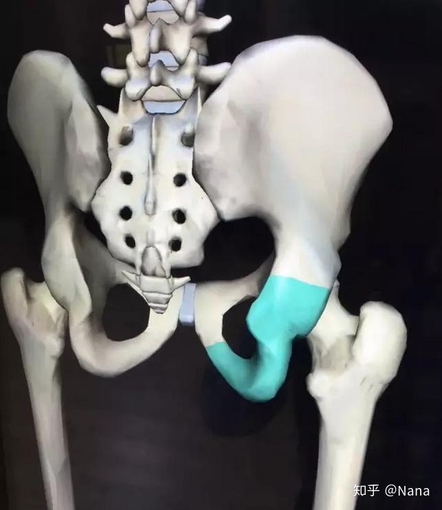 罪魁祸首丨骨盆不正