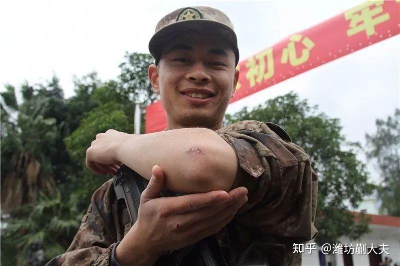小疤痕可能会影响我们的一生