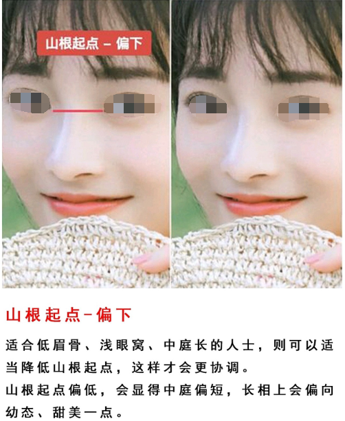 山根太高或者山根起点太高,就会形成这样的通天鼻,对于大多数人来说
