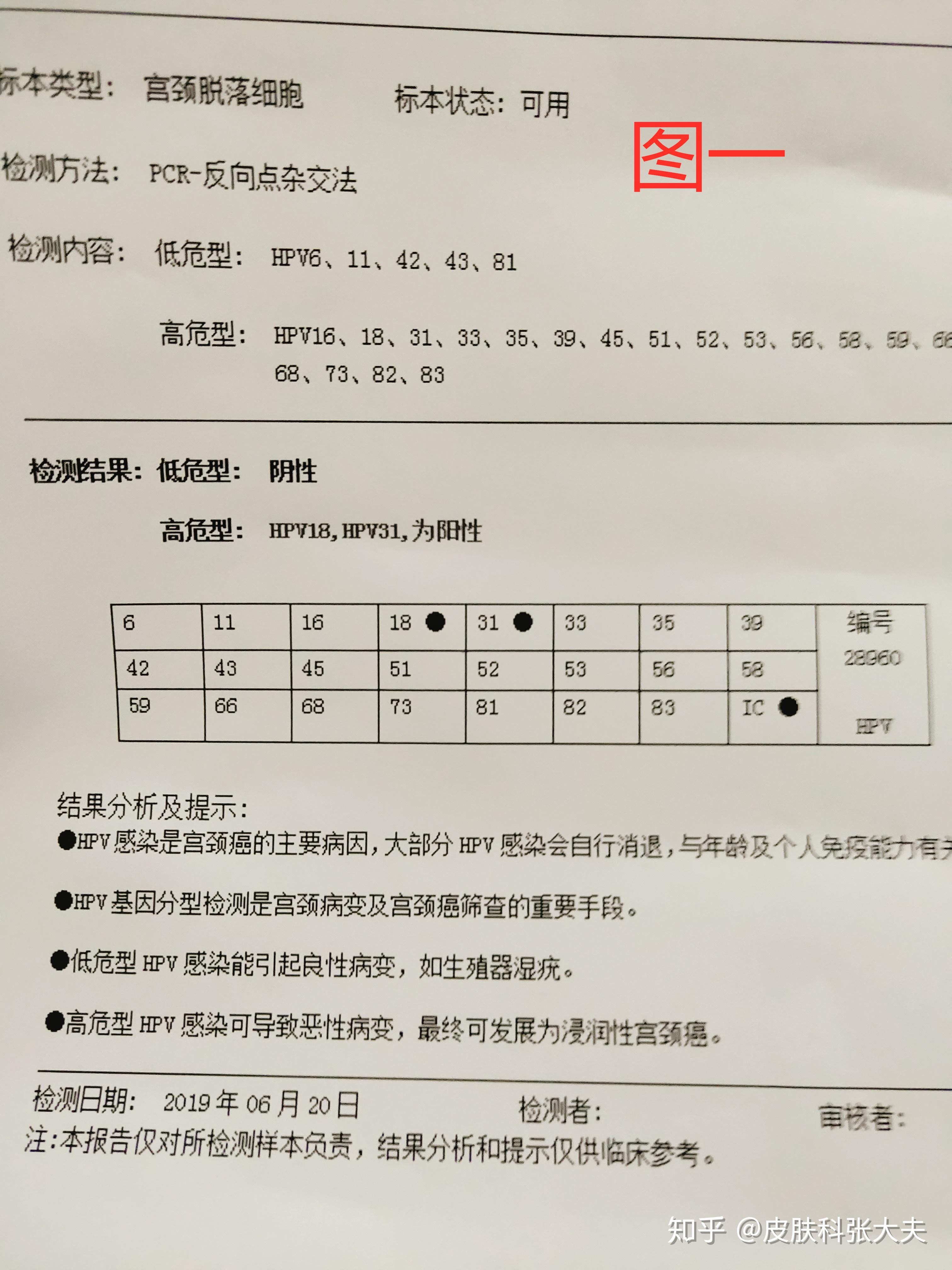王女士hpv18hpv31型高危转阴病例分享