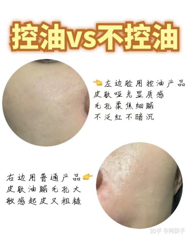 别再花冤枉钱了！教你油痘敏肌必备的控油乳液该怎么选？ 知乎 6710